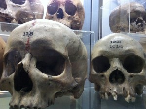 Skulls at the Hunterian Museum